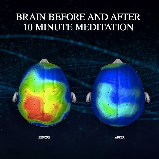 176518-The-Brain-Before-And-After-Meditation.jpg