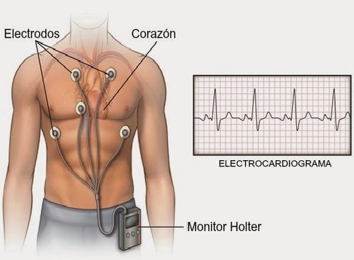 monitoreo+holter.jpg
