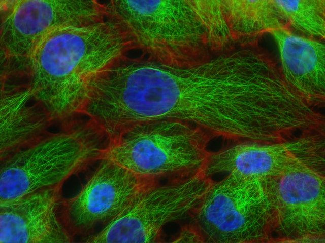 Cancer Cells.jpg