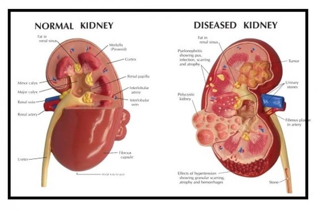 feature-kidney.jpg