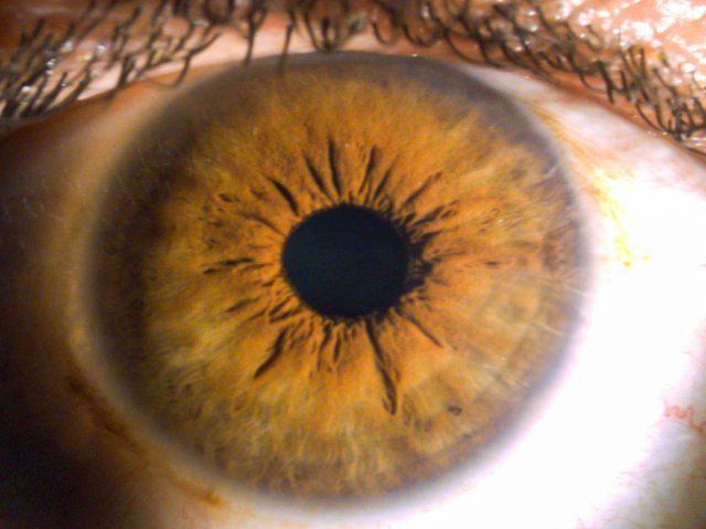 Human Eye Iris