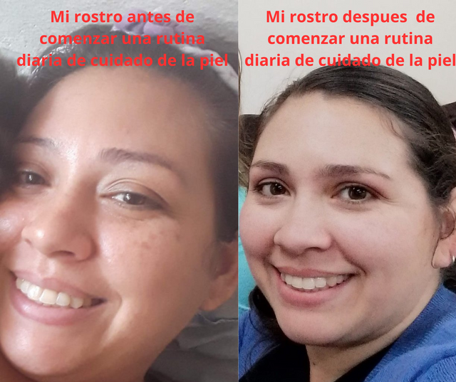 Mi rostro antes de comenzar una rutina diaria de cuidado de la piel.png