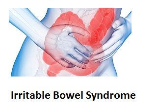 Irritable Bowel Syndrome (IBS).jpg