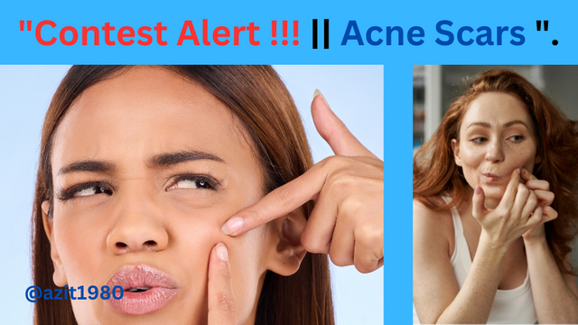 Contest Alert !!!  Acne Scars ..png