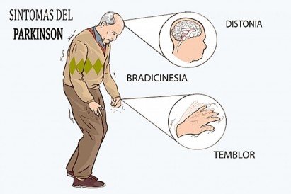 11-de-abril-dia-mundial-del-parkinson-pymes.org.mx.jpg