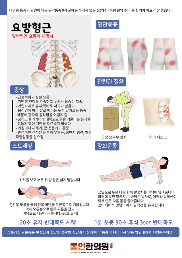 23)[근육처방전]요방형근 통인한의원.jpg