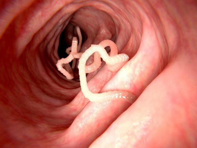 intestinal worms in humans.jpg