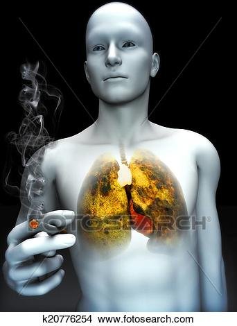smoking-kills-concept-drawings__k20776254.jpg