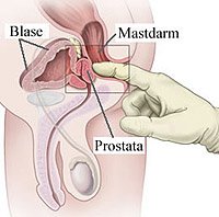 prostata.jpg