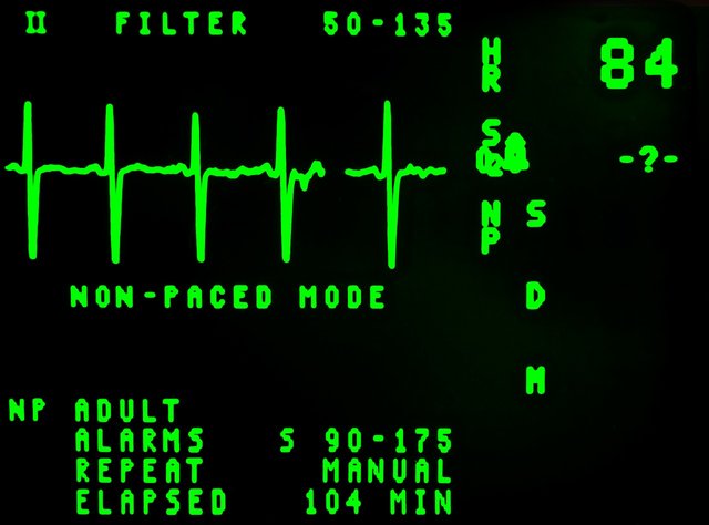 electrocardiogram-16948_1280.jpg