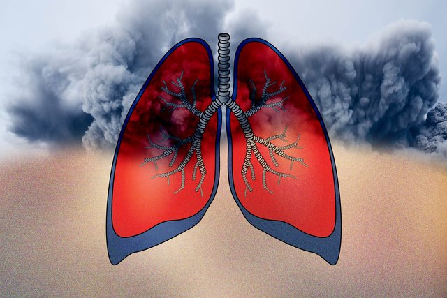 lung-gf9f533523_1920.jpg