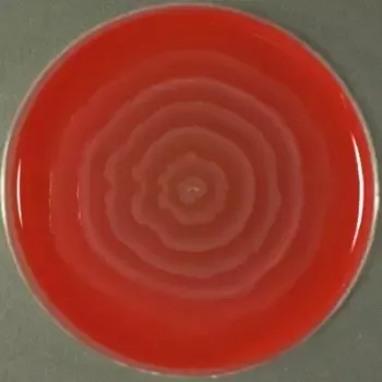 Proteus-mirabilis-in-blood-agar.webp