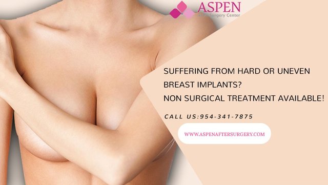 breast implant hards 2.jpg