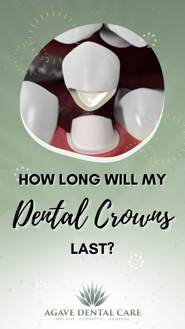 How Long Will My Dental Crown Last?.png