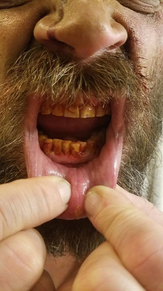 grimy teeth.jpg