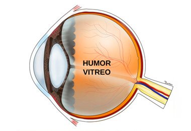 humor-vitreo-oftalmologista-campinas.jpg
