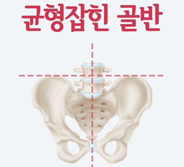 균형잡힌 골반.jpg