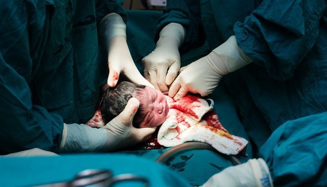 C-Section-baby.jpg