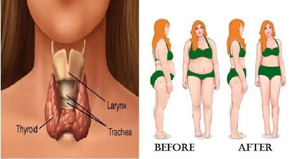 how to lose weight with low thyroid.jpg