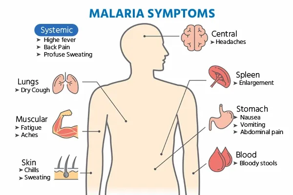 malaria-symptoms.webp