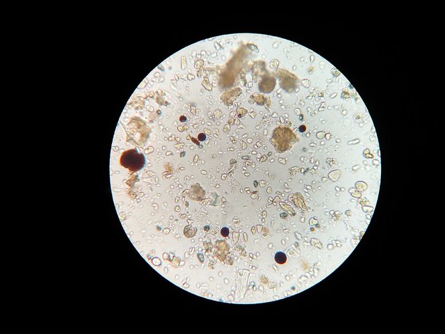 httpspixabay.comensoil-microbes-microscope-soil-sample-1802199.jpg