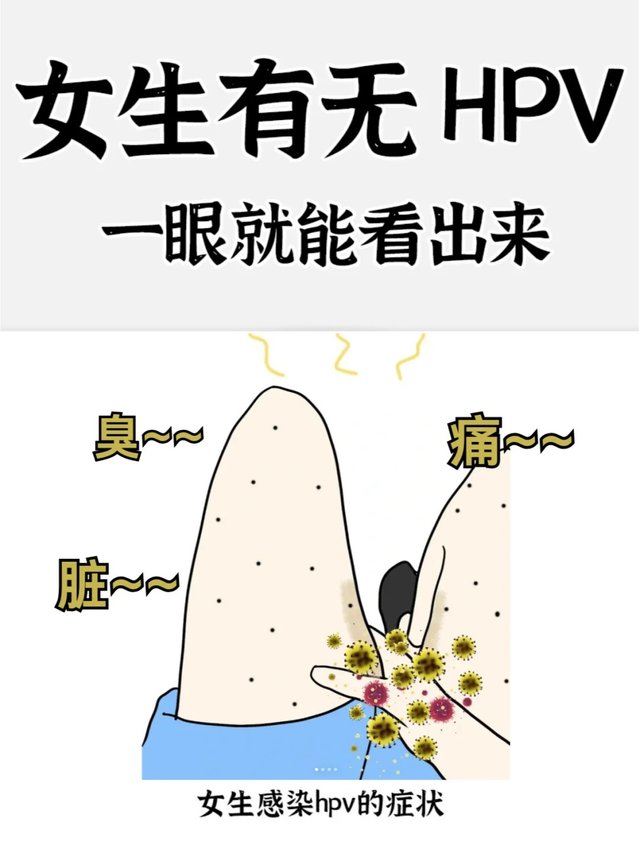 女生感染HPV的6大现象，一定要重视！_1_ZOG健康_来自小红书网页版.jpg