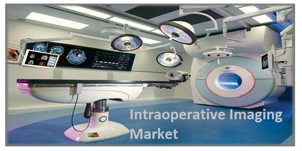 Intraoperative Imaging Market.jpg