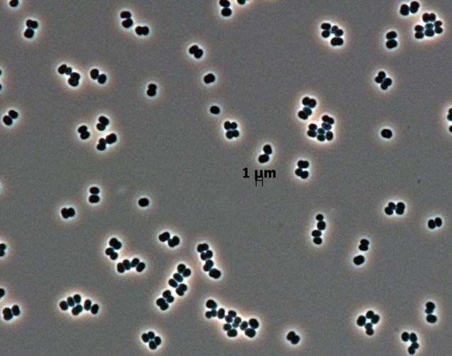 PIA17369-NASA-Bacteria-TersicoccusPhoenicis-20131106.jpg