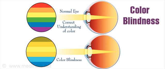 color-blindness.jpg