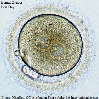 human zygot2 NinaSes 4.0 International   Эмбрион_человека_первые_сутки_развития.jpg