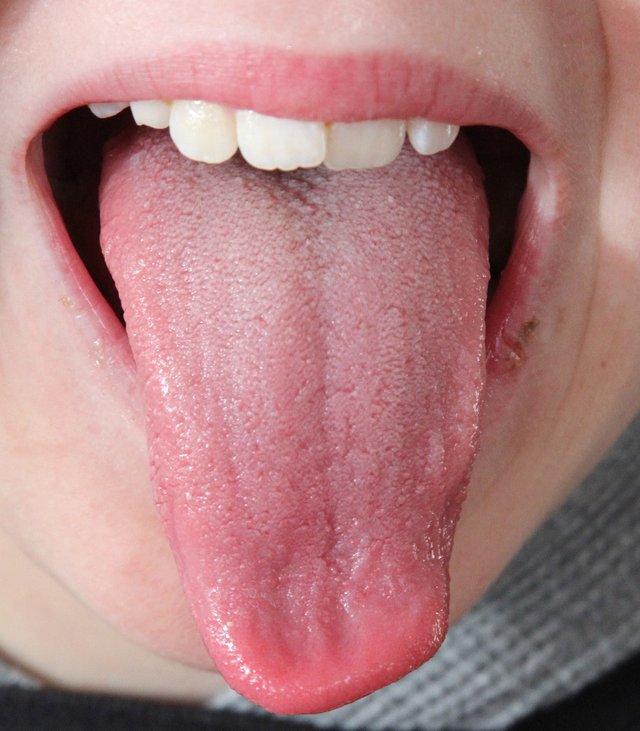 tongue-2a.jpg