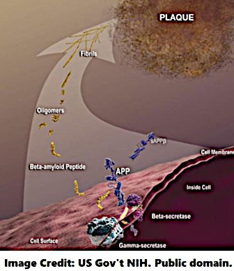 Alzheimers2 beta amyloid plaque formation NIH public.jpg