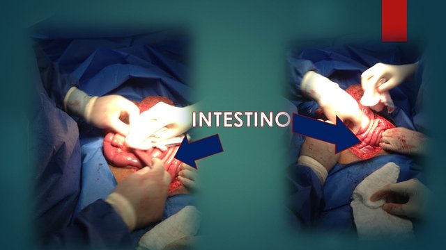 INTESTINO 1.jpg