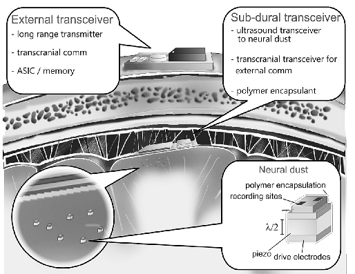 Schematic-illustration-of-the-neural-dust-system.png