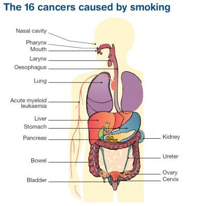2015-05-08-16-cancers-diagram.JPG