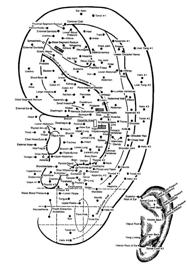 Ear-Acupuncture-l.jpg