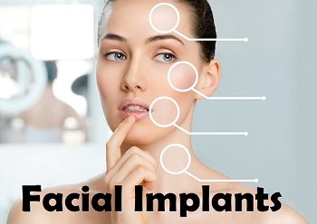 Facial Implants Market.jpg