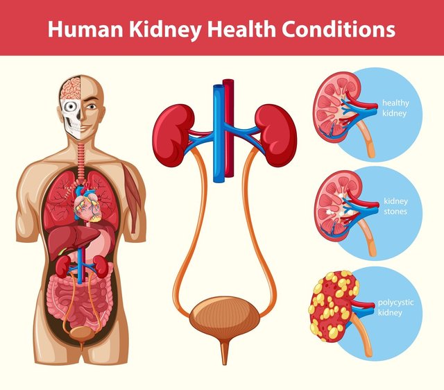 human-kidney-health-conditions-infographic_1308-51412.jpg