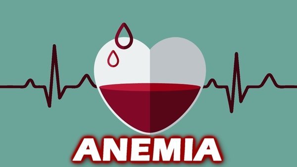 Anemia.jpg