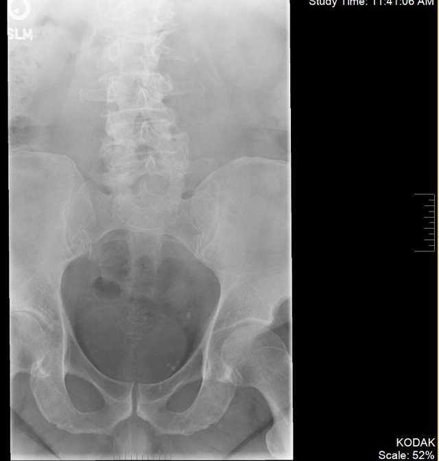 Civilian Ortho Lower spine1.JPG