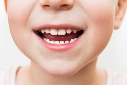 5 Surprising Causes of Dental Cavities in Children.jpg