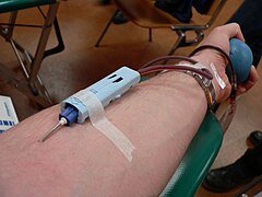 Blood_donation_-_photo_of_arm.jpg