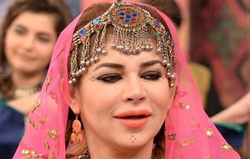 mishi khan plastic surgery