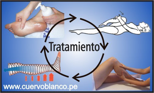 tratamiento