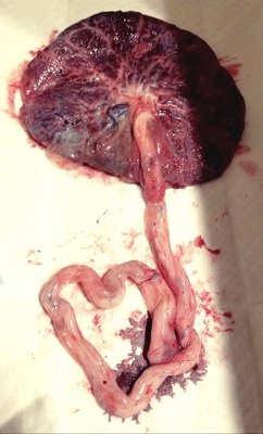 placenta Chloé.jpg