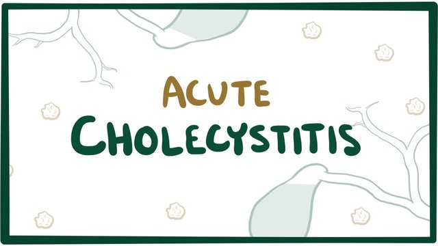 acutecholecystitis.jpg