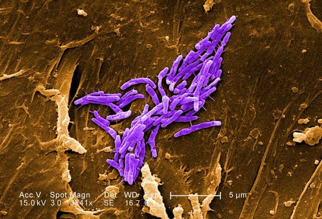 grampositivebacillirodshapedmycobacteriumfortuitumbacteria725x493.jpg