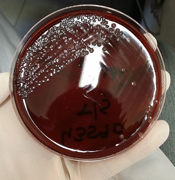 584pxNeisseria_meningitidis_Colonies_growth_on_New_York_City_Medium_Agar.jpg