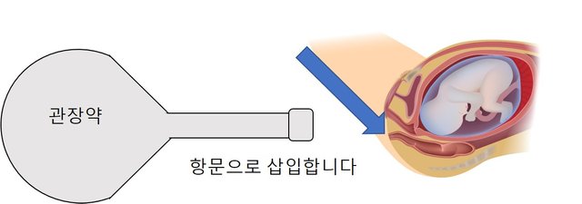 -3대 굴욕-관장과 내진3