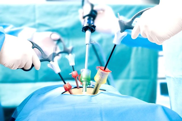 India Minimally Invasive Surgery Market